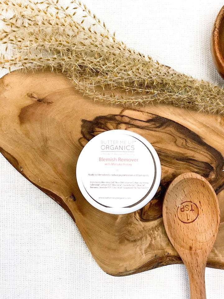 Organic Blemish Cream/ Dark Spot Remover / Scar Cream / Acne Spot Treatment - The Edible Petale Company